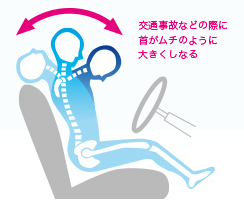 交通事故などの際に首がムチのように大きくしなる